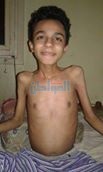 مواطن يستغيث بالمسئولين: أنقذوا أولادي من المرض