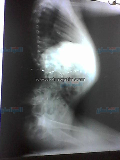 بالصور.. مواطن لوزير الصحة: "مرتبي لا يتجاوز 1000 جنيه وابني بيموت" 