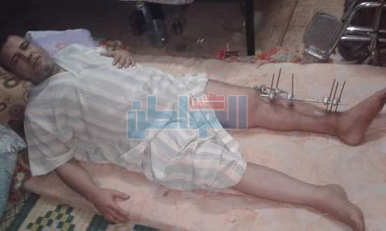 بالصور.. مواطن يستغيث: سيارة دهستني وأصبحت عاجز