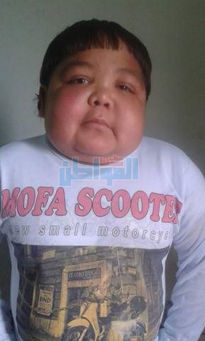 بالصور.. "أم" تستغيث بوزير الصحة لإنقاذ ابنها وعلاجه بالخارج