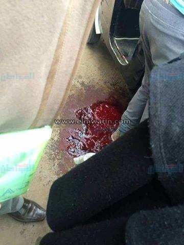 بالصور.. إصابة سائق "توك توك" بالخطأ في إطلاق نار عشوائي من أحد ضباط المنوفية