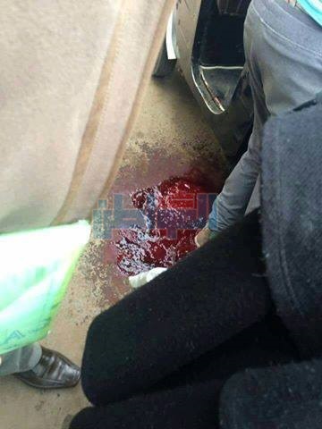 ننشر التفاصيل الكاملة لواقعة إصابة سائق "توك توك" بالخطأ بسلاح ضابط مرور