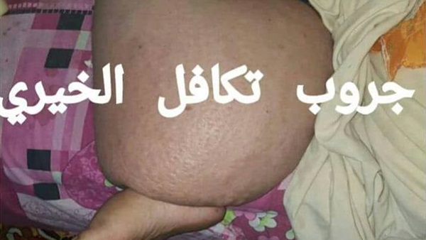 سيدة تناشد وزير الصحة