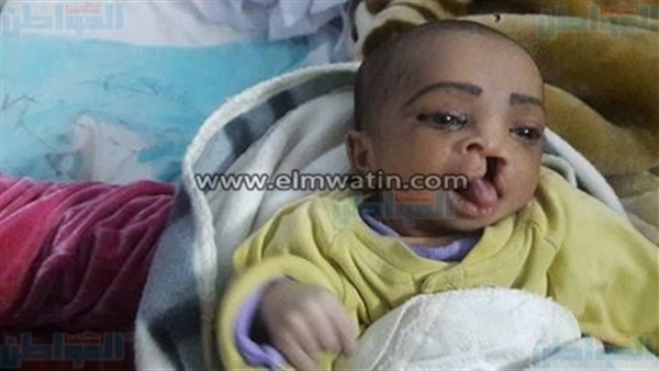 عملية تجميل