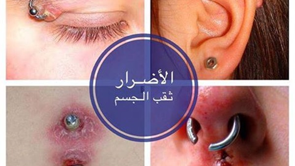 الثقب