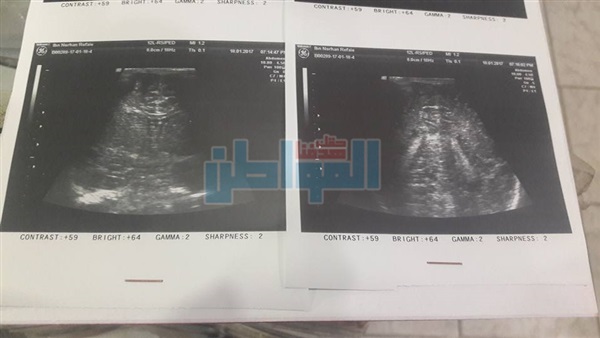 الأشعة الخاصة بالطفل