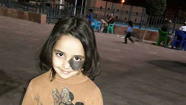 معاناة طفلة من سرطان