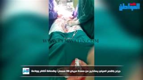 صورة من الفيديو