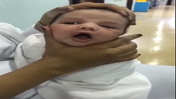 ممرضة تعبث بوجه رضيع