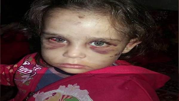 تعذيب أطفال - صورة