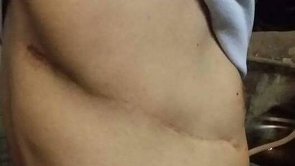 حرمانه من المعاش