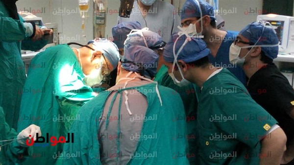 فصل التؤام الملتصق-جامعة