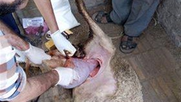 ولادة قيصرية