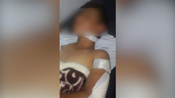 طعن طفل بمنجل بالشرقية