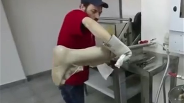 صناعة الأطراف