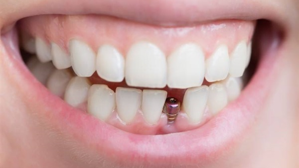 طب الأسنان الحديثة