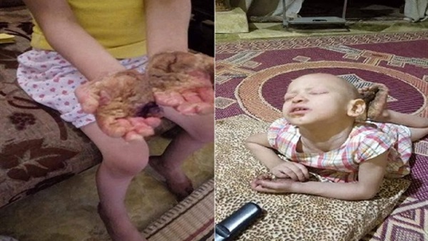 إستغاثة طفله