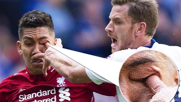 مهاجم ليفربول روبرتو