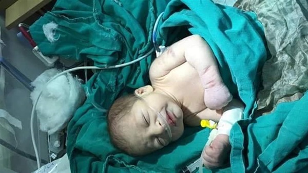 صورة للطفل الرضيع