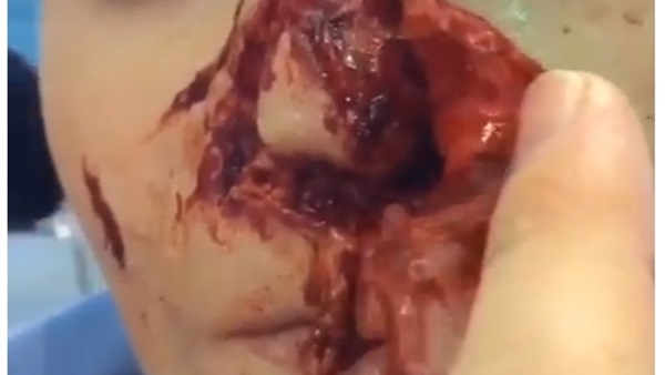 اضرار وحوادث سجائر