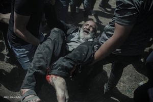 مسن فلسطيني مصاب