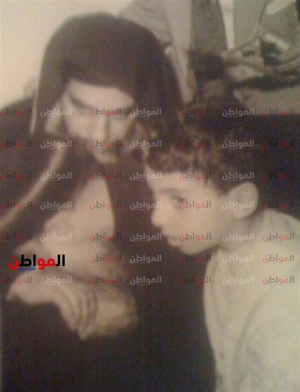 طفل القرعة الهيكلية